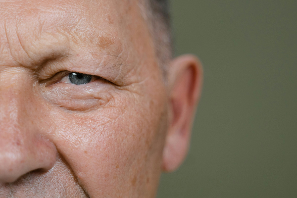 Collagen for Men - How to Improve Skin Elasticity and Build Muscle